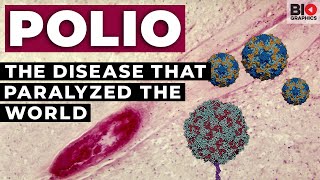 Polio The Disease that Paralyzed the World [upl. by Fitzsimmons]