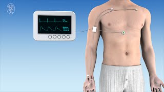 Hämodynamisches Monitoring Transfusion und Intensivmedizinische Basismaßnahmen [upl. by Margret410]