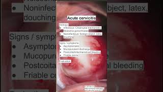 Acute cervicitis [upl. by Kumagai560]