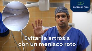 Evitar la artrosis con un menisco roto  Dr Oscar Ares [upl. by Madriene]