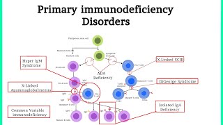 Pathology 40 Primary Immunodeficiency Disorders Xanuunada hoos u dhiga difaaca jidhka [upl. by Adnwahsor]