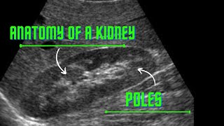 ANATOMY OF KIDNEY amp ITS POLES [upl. by Aig]