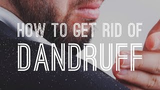 How to Get Rid of Dandruff  Quickly amp Reliably With Proven Solutions [upl. by Lydia]