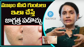 Tips To Remove Deep Acne Scars or Pimple Holes on Face  Dr Sailaja Surapaneni  Telugu Popular TV [upl. by Kauppi334]