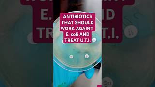 The antibiotics are AMIKACINAK MEROPENEMMEM CIPROFLOXACINCIP TAZOBACTAMTZP AND GENTAMICINCN [upl. by Him]