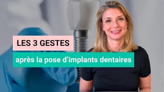 Implants Dentaires 3 Conseils Clés à Adopter Après la Pose [upl. by Nerrag]