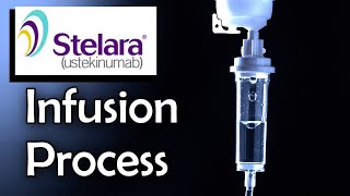 Stelara Infusion Process Ulcerative Colitis Treatment [upl. by Elka]