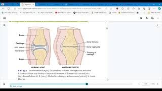 4346 CONCEPTS OF CARE FOR PTS WITH ARTHRITIS AND TOTAL JOINT ARTHROPLASTY PART 1 [upl. by Alodi]