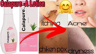 Calapure A Lotion Uses  Calamine Lotion  Review in English [upl. by Gabby778]