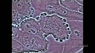 Mitosis in an animal cell Under the Microscope [upl. by Nissensohn697]