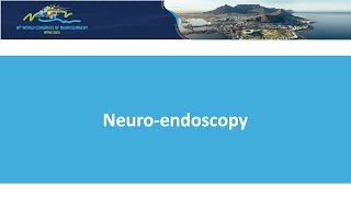 Neuroendoscopy [upl. by Adnarom]