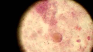 Blastocystis hominis Trophozoite [upl. by Hsaka]