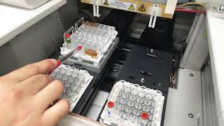 Capillary Electrophoresis [upl. by Isobel]