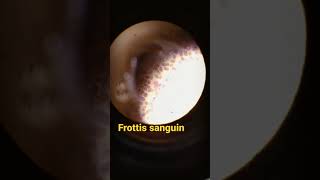 frottis sanguin sous Microscope [upl. by Newol]