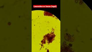 Leucocitos en heces al microscopio [upl. by Plume]