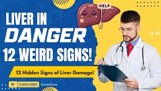 Hidden Signs of Liver Damage  12 Strange Symptoms of Liver Trouble  Aware Zone [upl. by Den]