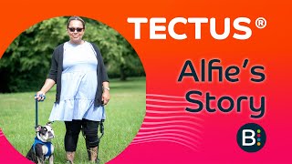 Tectus ® Case Study Alfie Wright Paralympic ParaPowerlifter [upl. by Banwell965]