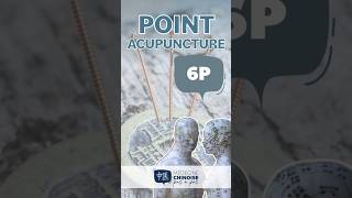 POINT D’ACUPUNCTURE  6P  Kong Zui acupuncture acupuncturepoints medecinechinoise [upl. by Gerti]