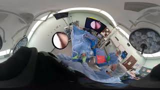 Left Knee Arthroscopy Setup and Loose Body Removal  GoPro Fusion 360 [upl. by Feingold]