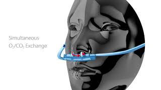 SunMed VentFLO EtCO2 Sampling Cannula Product Introduction [upl. by Cacilie]