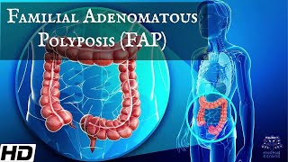 Familial Adenomatous Polyposis  FAP Everything You Need To Know [upl. by Ailedroc705]