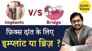 Dental Implants vs Tooth Bridge क्या है बेहतर Seraphic Dental Indore [upl. by Chilton]