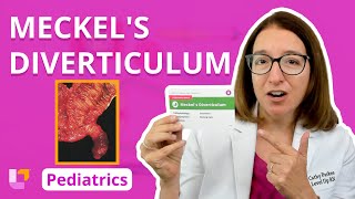 Meckels Diverticulum Alterations in Health  Gastrointestinal Pediatrics  LevelUpRN [upl. by Aric]