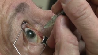 Eyeball injections equal eyepopping profits [upl. by Adrianne]