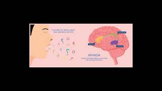 What is APHASIA TAGALOG [upl. by Artsa]