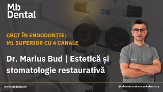 CBCT in endodontie M1 superior cu 4 canale  explore details  marius bud [upl. by Assirat]