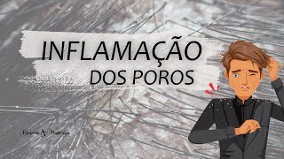 CASPA  UMA INFLAMAÇÃO DOS POROS [upl. by Feodora456]