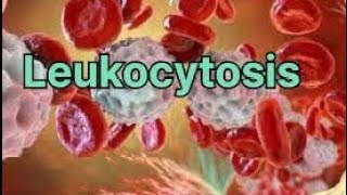 Leukocytosis  Definition of leukocytosis  Type of leukocytosis  Causes of leukocytosis💯 [upl. by Noirad]