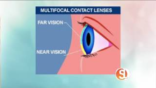 TIP Multifocal Contact Lenses [upl. by Razatlab]