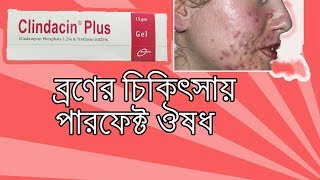 Clindacin Plus Gel  what is clindamycin gel used to treat Bangla [upl. by Mihar287]