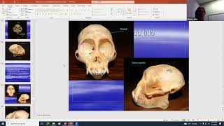 VERTEBRATE SKULL ANATOMY amp EVOLUTION part 2 [upl. by Melmon142]