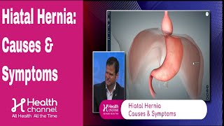 Hiatal Hernia Causes amp Symptoms [upl. by Halet]