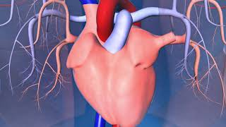 Catheter Ablation What is it and how does it help an irregular heart beat [upl. by Ojadnama]