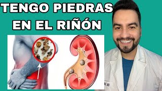 TENGO PIEDRAS EN LOS RIÑONES  LITIASIS RENAL  COMO ELIMINAR PIEDRAS DEL RIÑÓN  DR DAVID CAMPOS [upl. by Ihsakat]