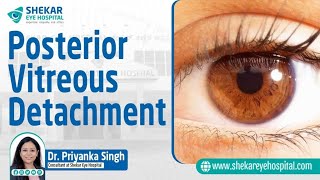 What is Posterior Vitreous Detachment What are its symptoms  Shekar Eye Hospital [upl. by Noble]