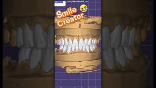 Exocad Smile creator 😂😂 [upl. by Tait]