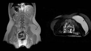 Difference Between Hyperventilation and Tachypnea [upl. by Sayer]