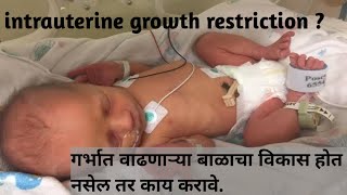 intrauterine growth restriction iugr shorts ytshorts [upl. by Hoover366]