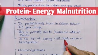 Protein  Energy Malnutrition  Kwashiorkor  Marasmus  Biochemistry [upl. by Teresita759]