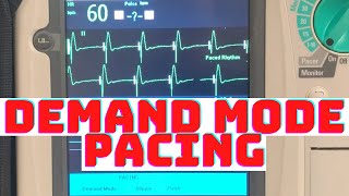 How to Properly Initiate Demand Mode TCP Transcutaneous Cardiac Pacing Why is it Safer over Fixed [upl. by Aitsirhc309]