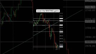 TRADING IS 90 waiting and 10 execution forex trading xauusd viralshort forextrading [upl. by Unni]