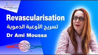 Chirurgie Vasculaire  Revascularisation avec le Dr Ami Moussa  تسريح الأوعية الدموية [upl. by Genevieve]