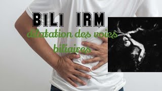 BILI IRM  Importante Dilatation des voies biliaires [upl. by Pirbhai]