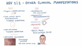 HSV  Clinical Presentation  Part 2 [upl. by Ewell725]