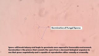 Germination of Fungal Spores Demonstration [upl. by Zaremski]