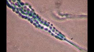 Penicillium cheresanum showing single celled conidia [upl. by Rivera862]